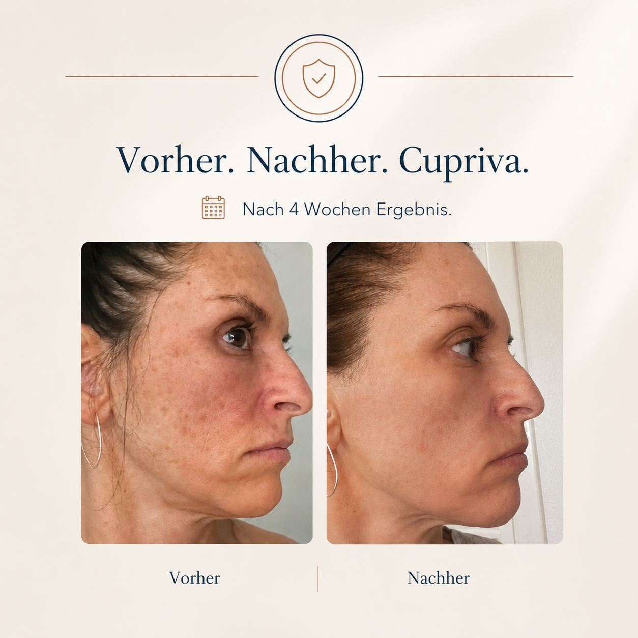 Cupriva Peptide Cream